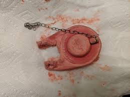 a worn out toilet flapper